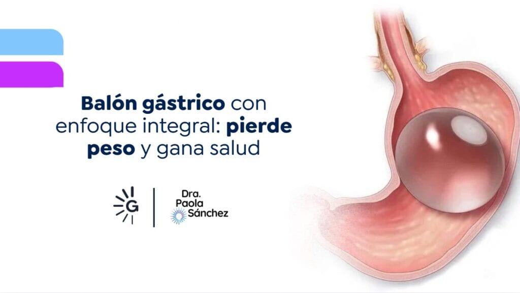 Balón gástrico-Dra. Paola Sánchez