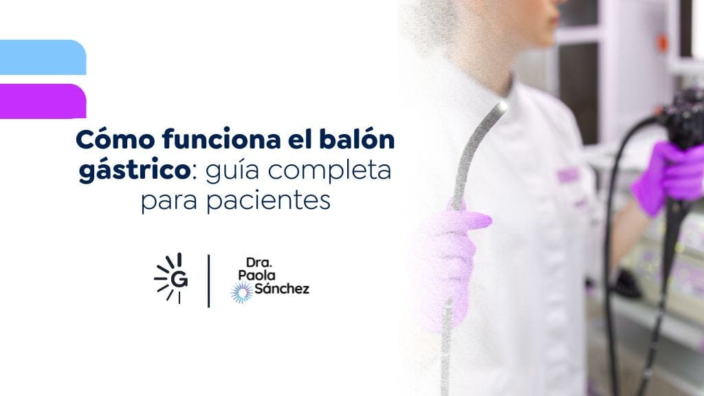 cómo funciona el balón gástrico explicado por la Dra. Paola Sánchez