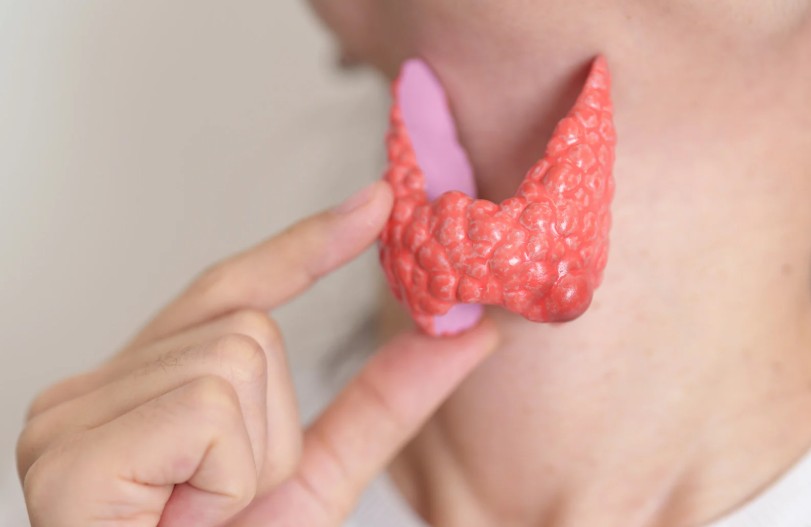 Cómo bajar de peso si tengo hipotiroidismo en Colombia - Dra. Paola Sánchez